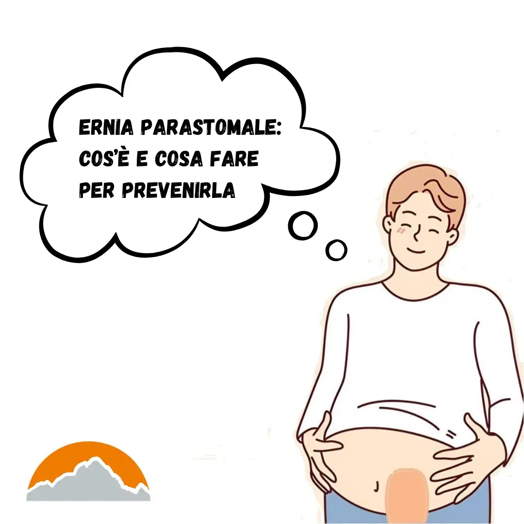 Ernia parastomiale